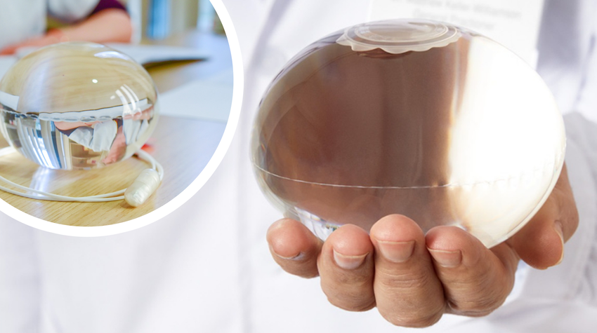  NOU la Arcadia: Balonul gastric Allurion, tratamentul minim invaziv al obezității