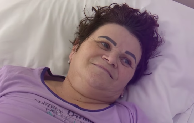  Femeie cu o tumoră gigant de 20 de cm operata cu succes de medicii de la Spitalul de Neurochirgie Iasi
